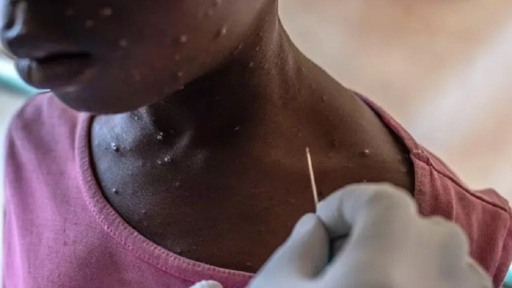 Agência Brasil Vacina brasileira contra a mpox está próxima dos testes em humanos